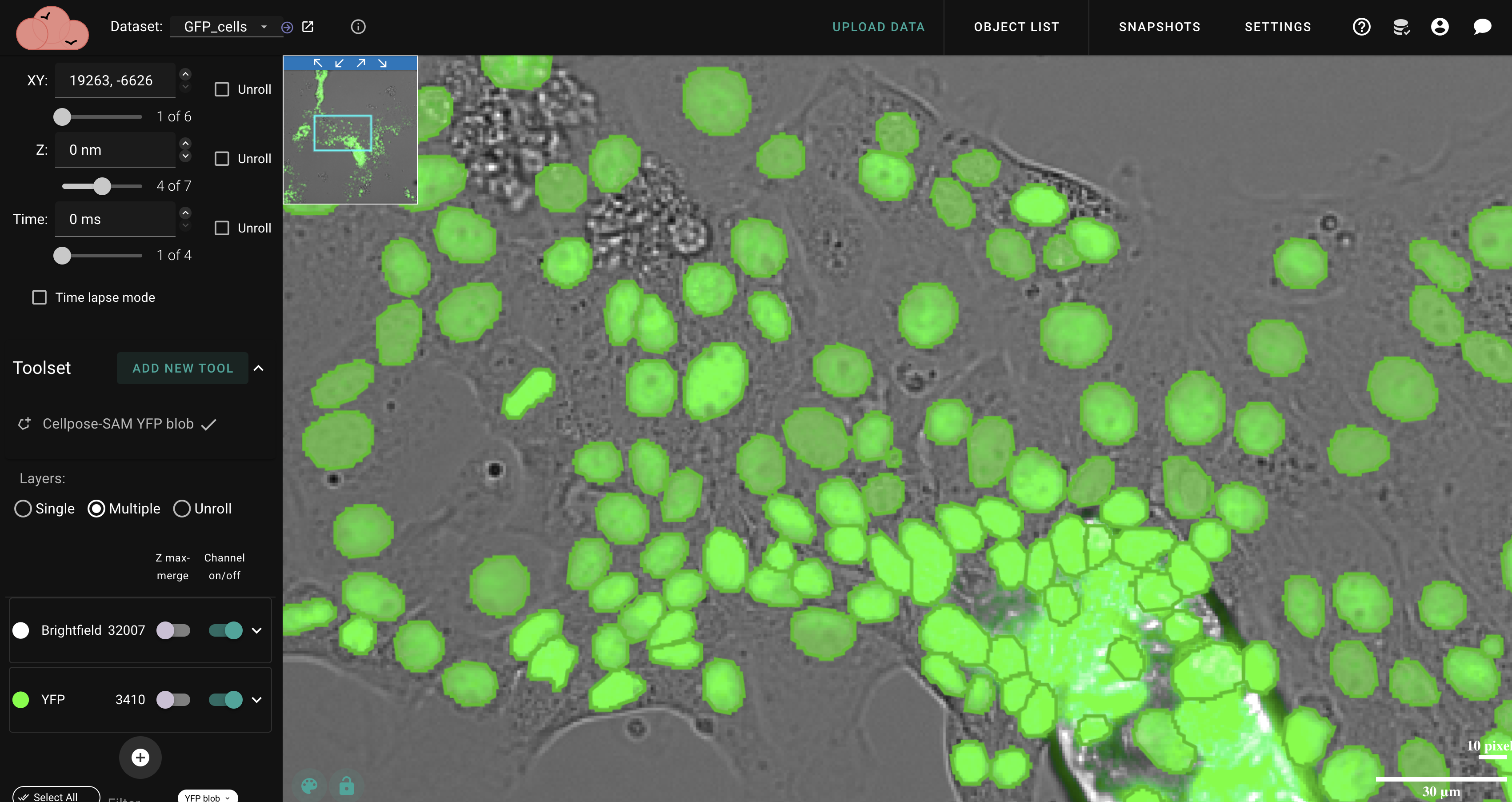 NimbusImage app showing cell segmentation with GFP fluorescence overlay